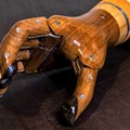 Handprothese